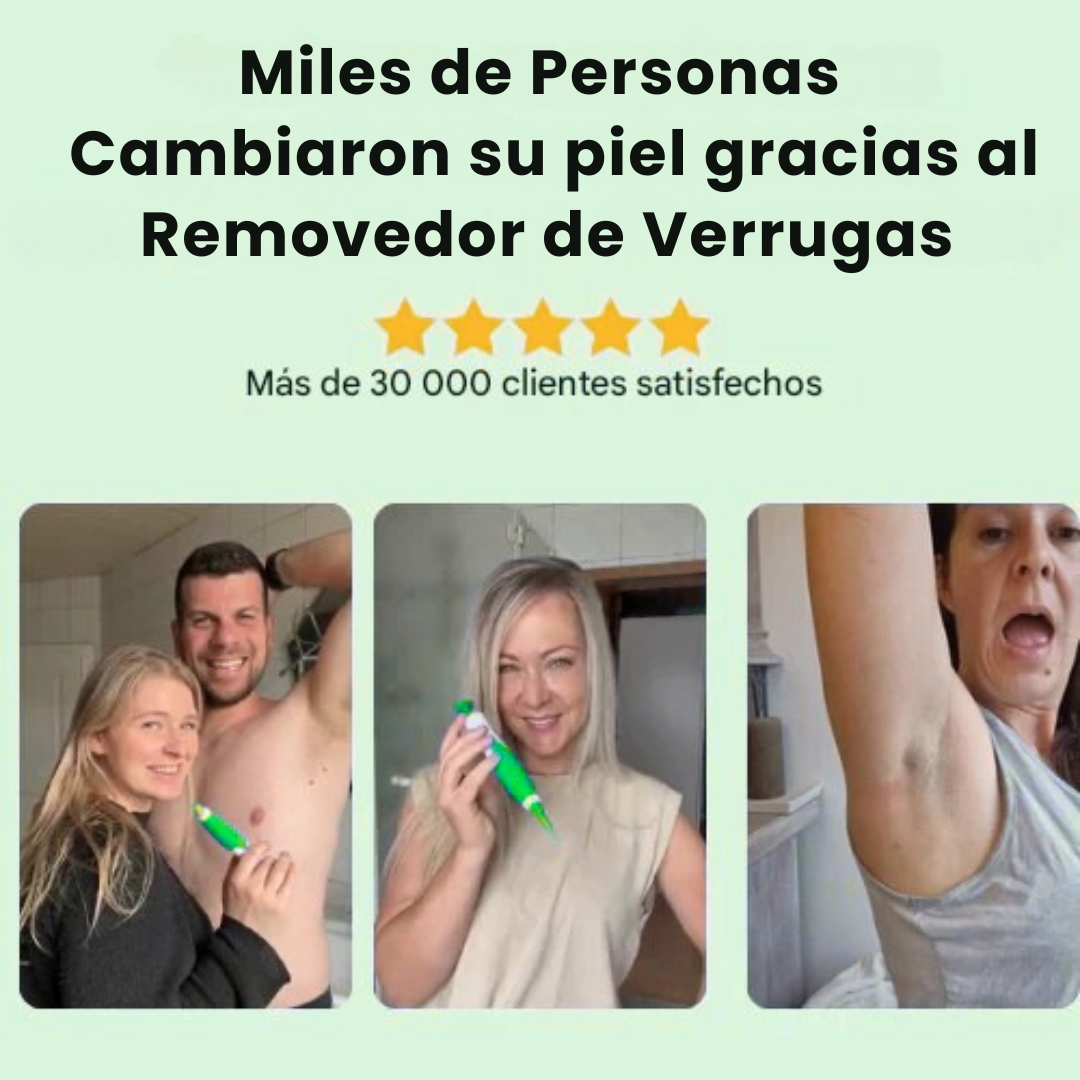 Removedor de Verrugas Profecional
