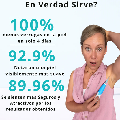 Removedor de Verrugas Profecional