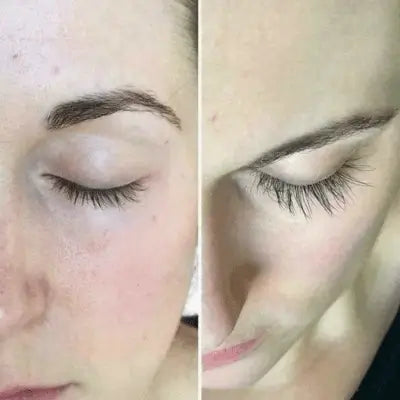 Alargador de Pestañas + SkinDion🎁