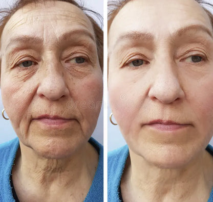 2 Cremas Sadoer + SkinDion🎁